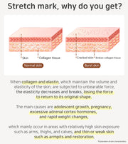 BEBELUNA, Pregnancy Stretch Mark Cream, Maternity Belly Balm, Turn Skin Balm, Safe Skincare for Pregnant Women, Organic Prenatal Moisturizer, Turn Skin Balm, 7.05 oz (200g)