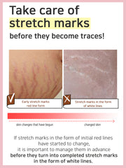 BEBELUNA, Pregnancy Stretch Mark Cream, Maternity Belly Balm, Turn Skin Balm, Safe Skincare for Pregnant Women, Organic Prenatal Moisturizer, Turn Skin Balm, 7.05 oz (200g)