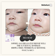 BEBELUNA, Mild Care Balm (2 Count), Hypoallergenic, 98% Natural Ingredients, 13 Herbal Extracts, All-in-One Moisturizer for Infants, Kids, Teens & Adults